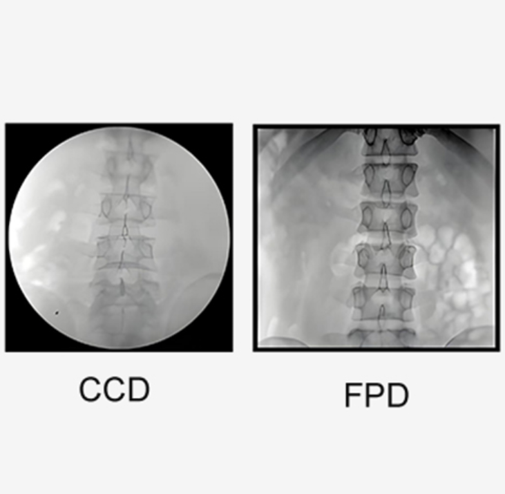 digital C-arm system(8)