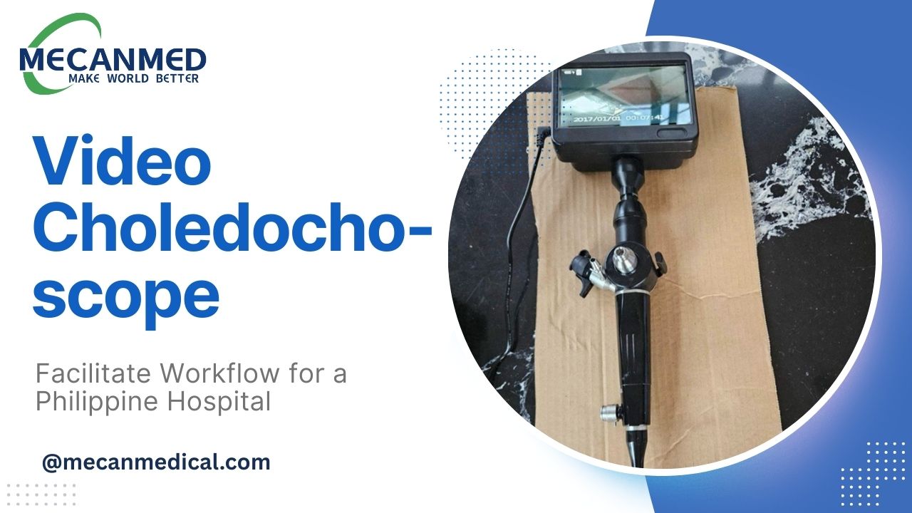 Video Choledochoscope for Philippine Hospital: Facilitating Workflow