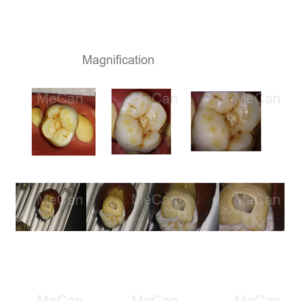 Operazione Microscope Magnification
