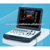 3D Laptop Doppler Launi Ultrasound Scanner