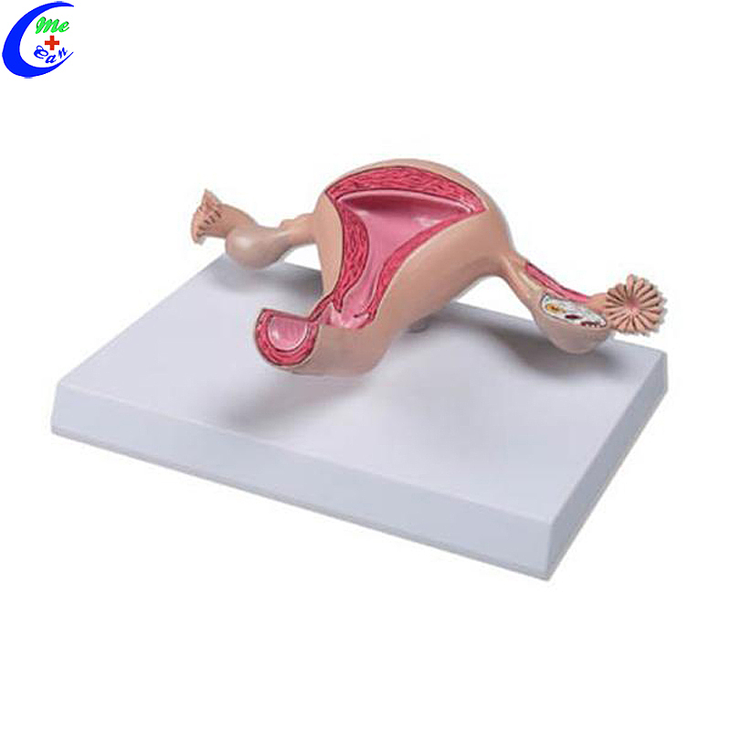 High Quality Medical Anatomical Uterus Model Wholesale - Guangzhou MeCan Medical Limited