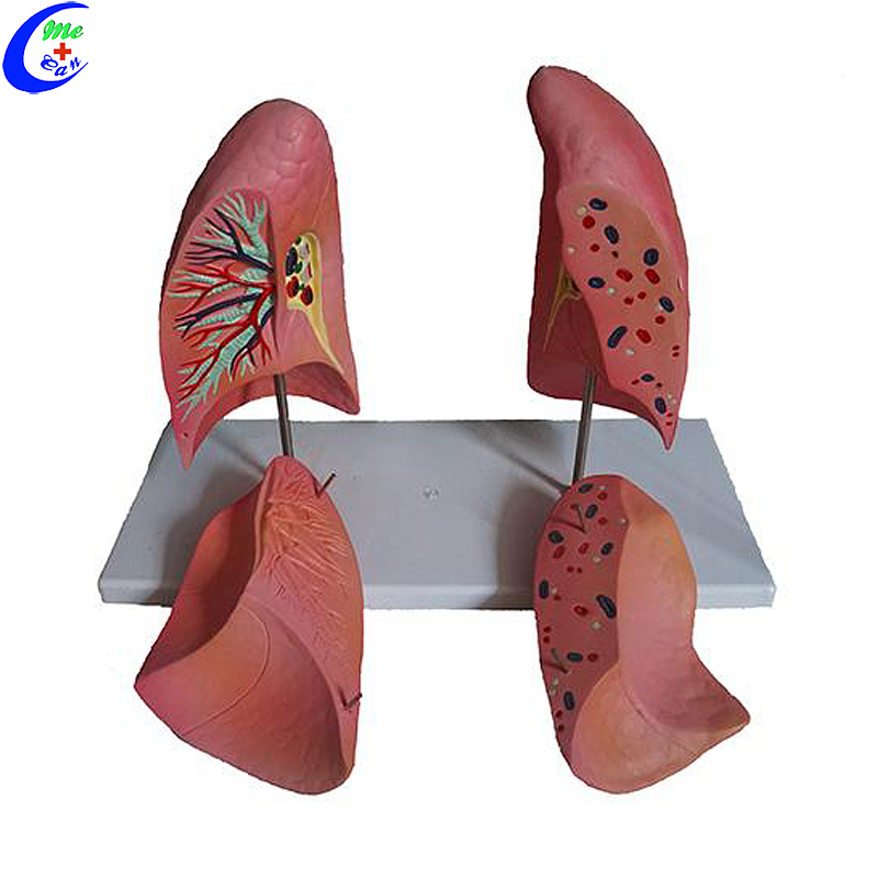Best Lung Anatomic Model Factory Price - MeCan Medical