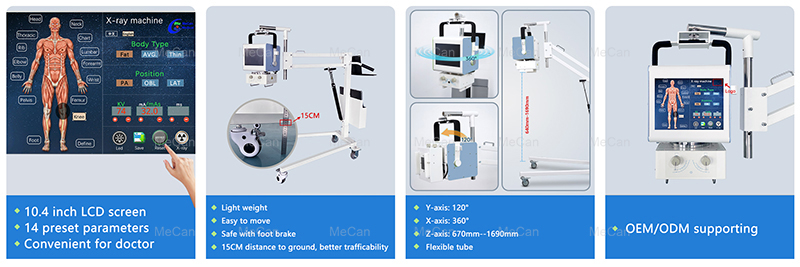 Features of 5kw portable x ray machine