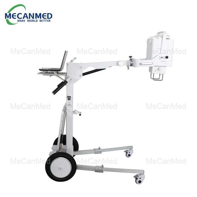 5.6kW Digital Mobile X Ray