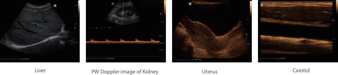 ultrasound စနစ် w