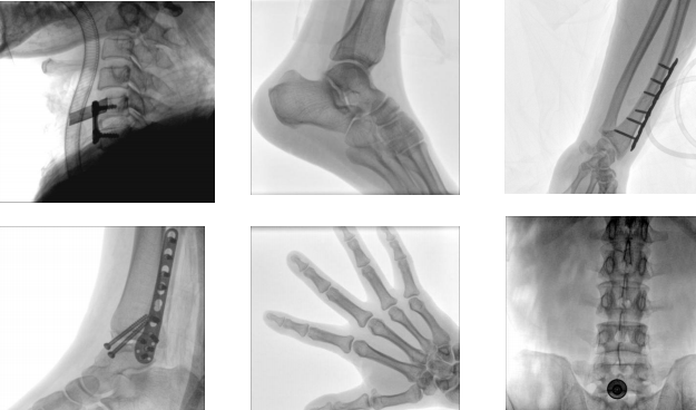 FPD C-Arm X-Ray System