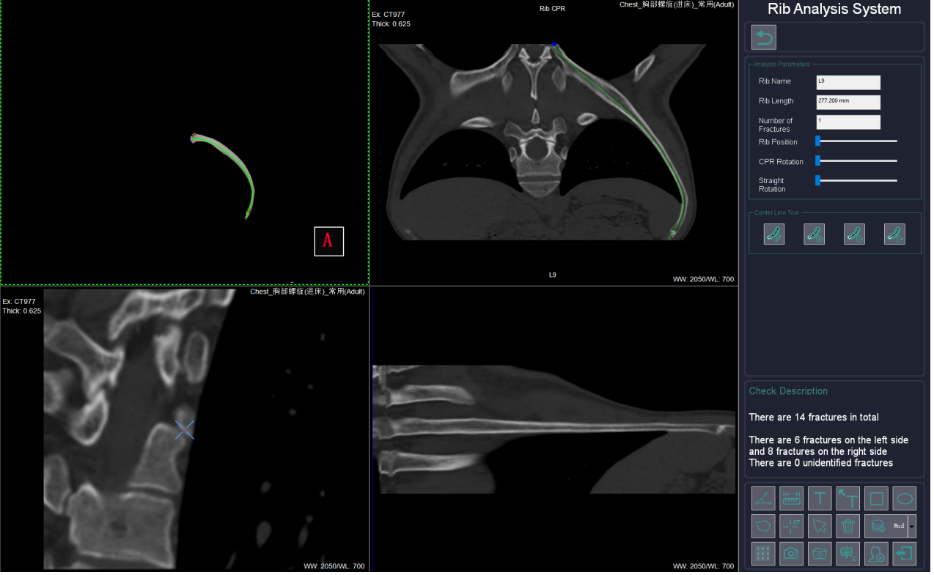 Comment les appareils de tomodensitométrie aident aux soins d'urgence ...