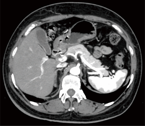 ct-scan-advanced-algorithm