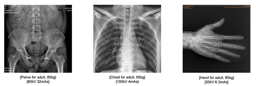 5.6kW MX-DR056A16 X Ray Machine images