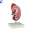 China Human Anatomy Kidney Models manufacturers - MeCan Medical