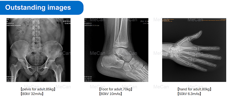 Excellent Images of Flat Panel Detector for Human