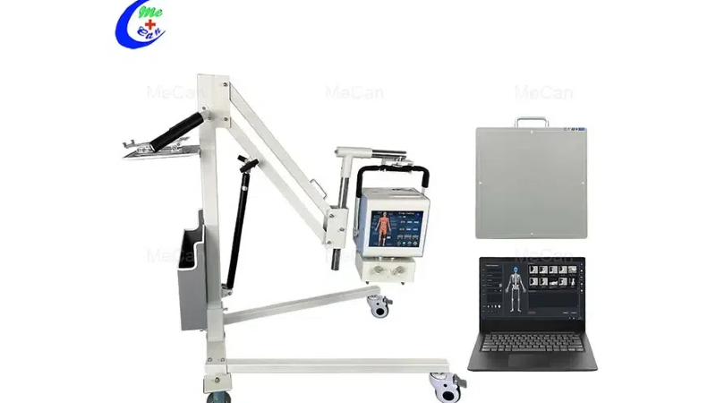 Revolutionizing Diagnostics: How Digital X-ray Machines Are Transforming Modern Healthcare
