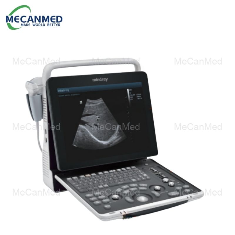 Mindray DP-50 Ultrasound Diagnostic System (2)