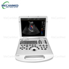 Portable Digital Color Doppler Ultrasound System