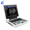 Popoln digitalni ultrazvočni diagnostični sistem
