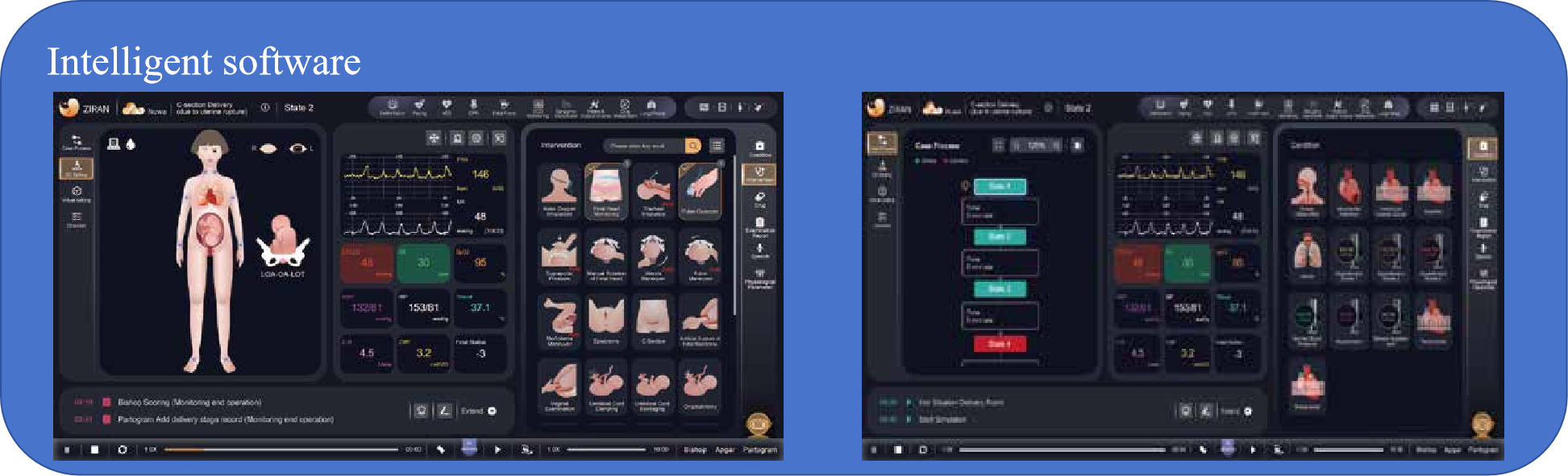 Birth Simulator intelligent software