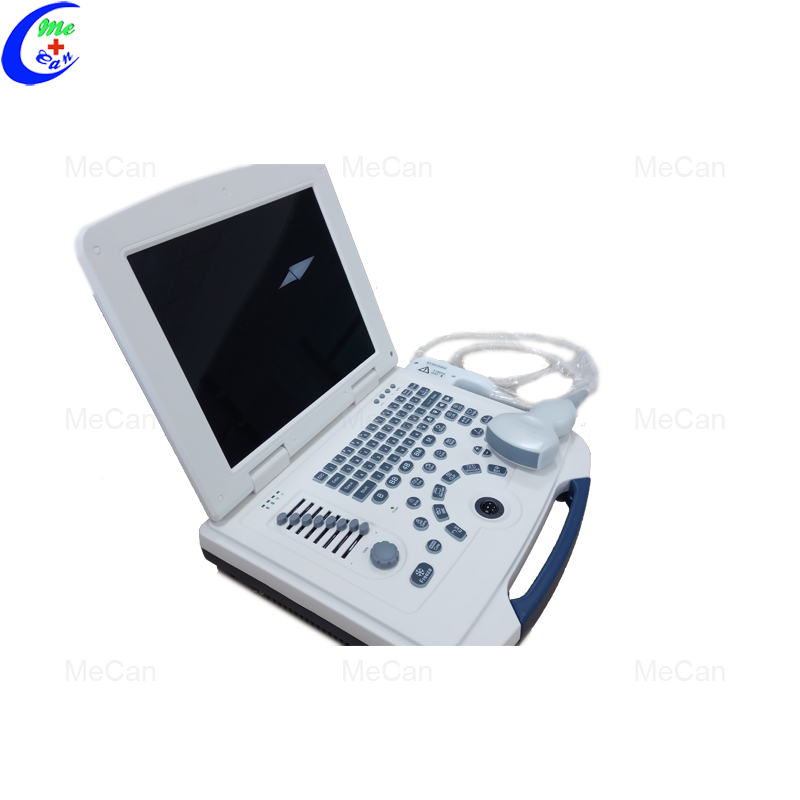 Best Quality Portable Ultrasound Scanner Machine, Full-Digital Laptop Ultrasound Scanner Factory