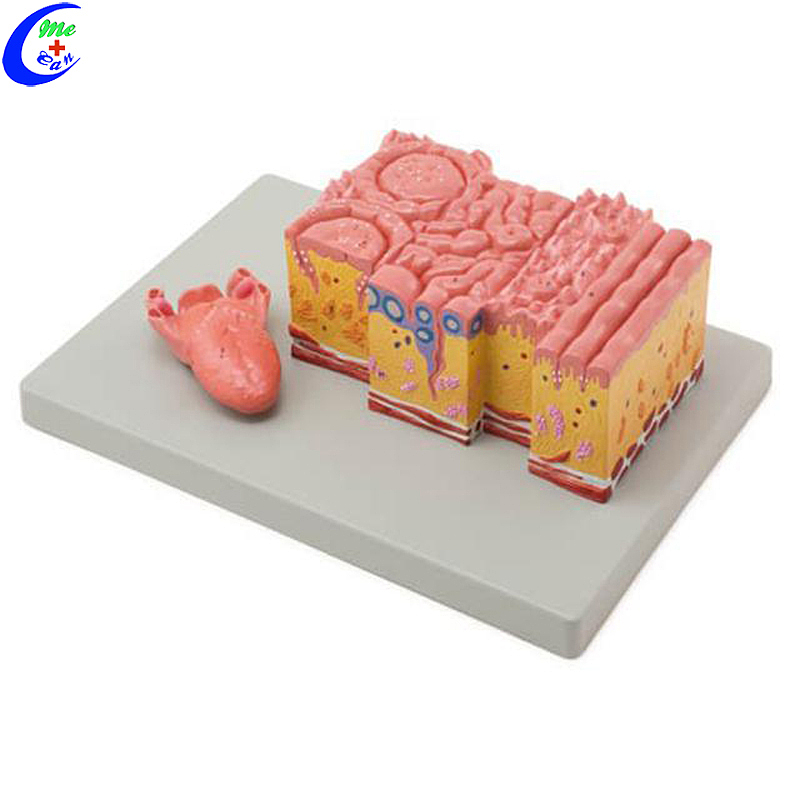 High Quality 3D Anatomy Skin Structure Model Wholesale - Guangzhou MeCan Medical Limited