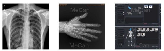 Test image of Mobile DR X Ray Machine