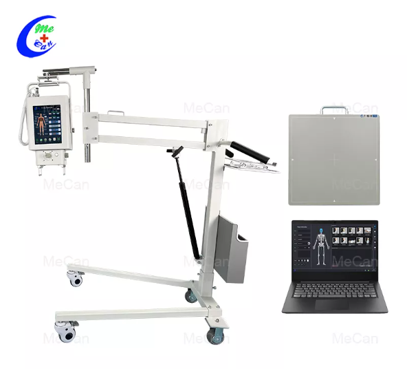 How Much Does A Portable X-Ray System Cost?