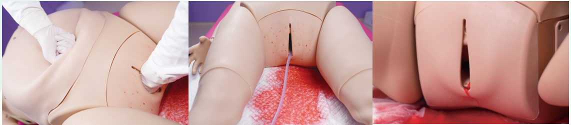 MECANMED MCE0937 simulating postpartum hemorrhage with adjustable bleeding system