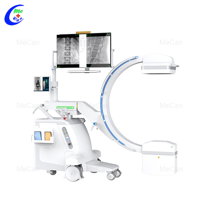 Profesjonelt r&oslash;ntgensystem C-arm r&oslash;ntgenmaskin for driftsprodusenter