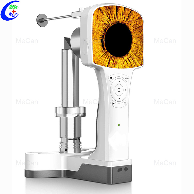 細隙灯 - 眼科検査