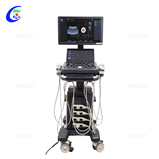 Trolley 4D Ultrasound Scanner