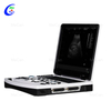 Laptop Black ug White Ultrasound Machine