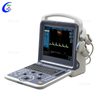 Portable Ultrasound Scanner | Digital Ultrasound Machine