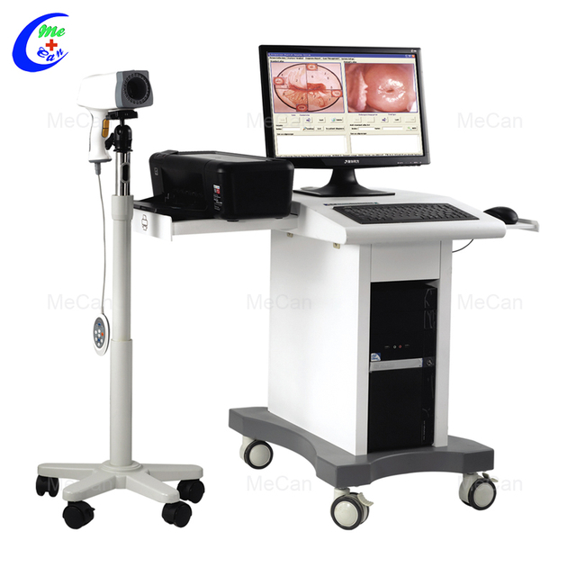 Quality High Quality Trolley Digital HD Video Colposcope for Gynecology Manufacturer | MeCan Medical