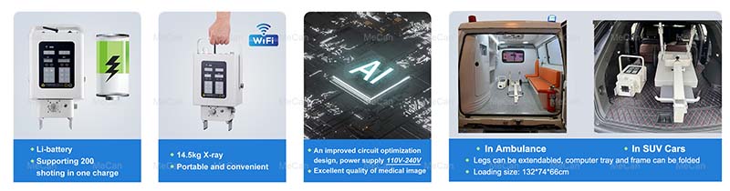 Features of 5.6KW Loadable X Ray Machine with Li-battery