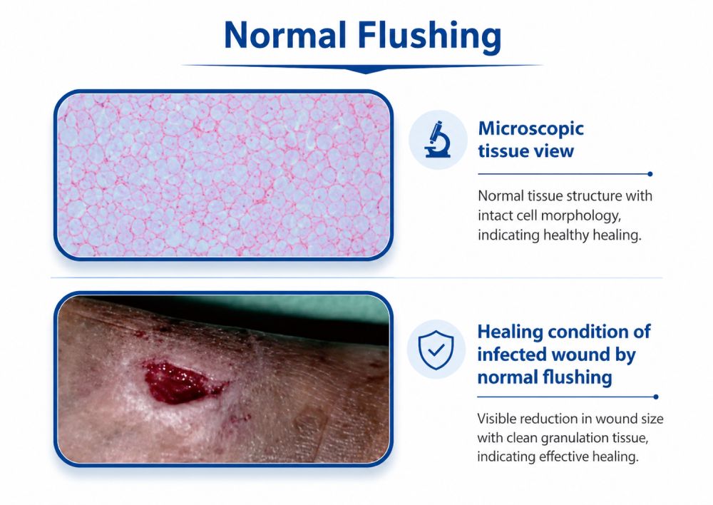 Ultraschall Wound Debridement Apparat fir Spidol Wound Care