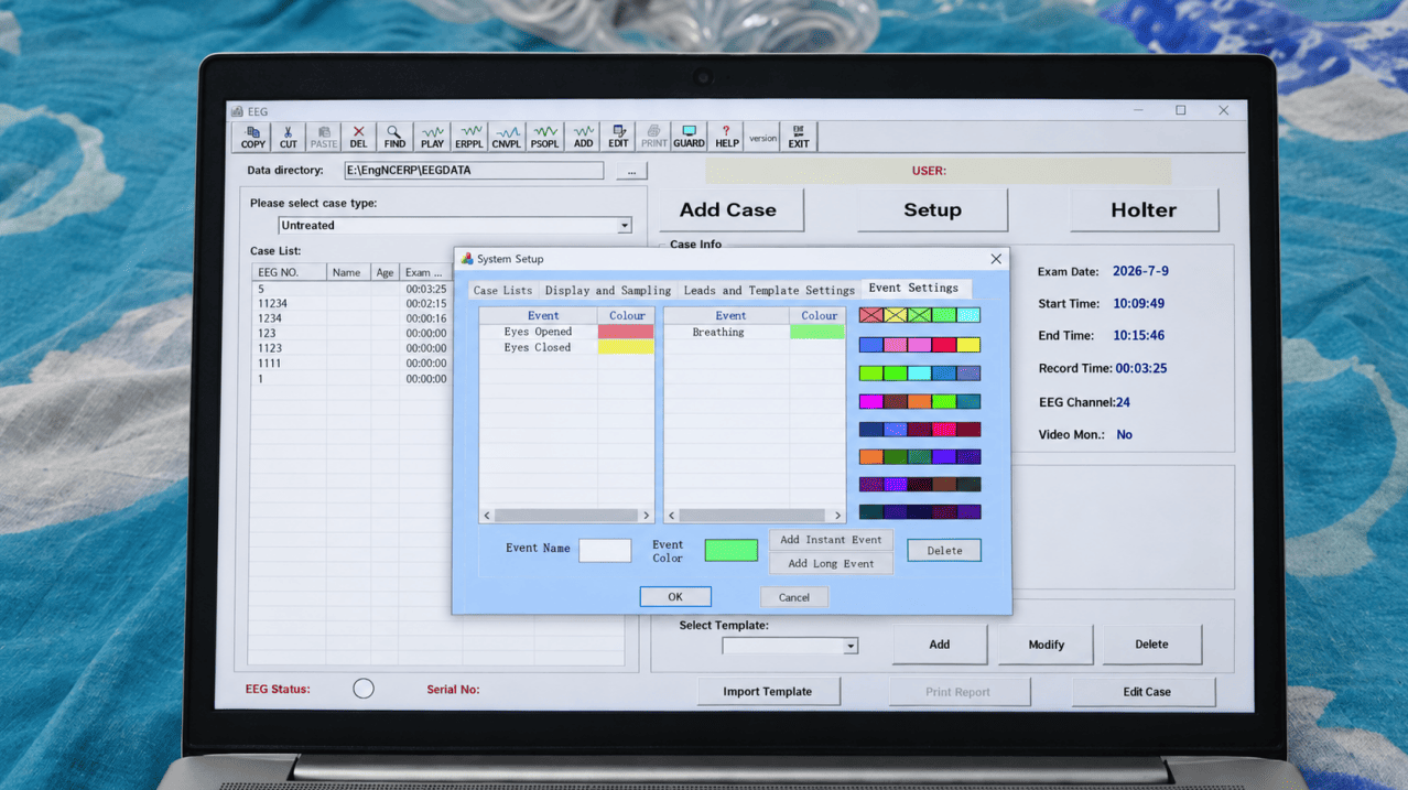 EEG software configuration interface displayed on a laptop during medical equipment commissioning.